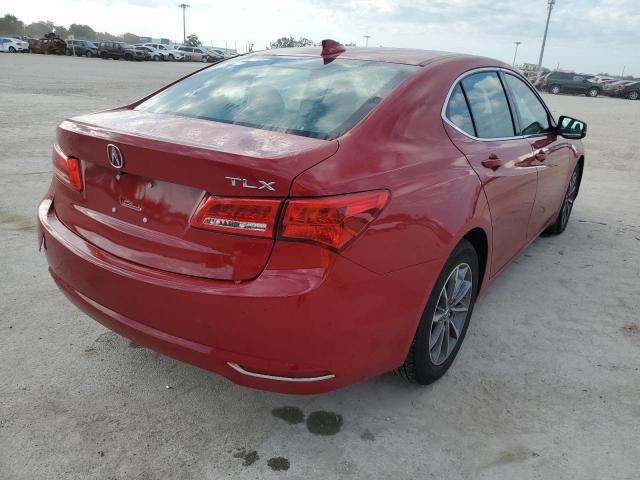 19UUB1F39JA004712  acura tlx 2018 IMG 3