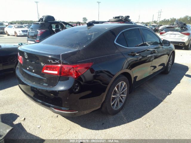 19UUB1F3XJA002029  acura tlx 2018 IMG 3