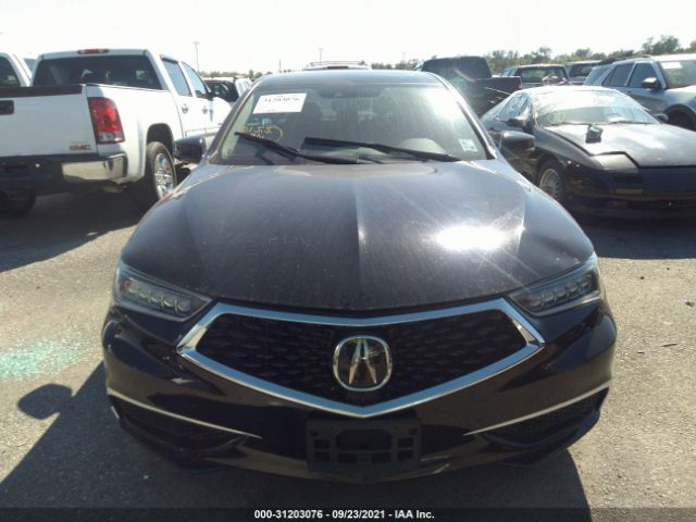 19UUB1F3XJA002029  acura tlx 2018 IMG 5