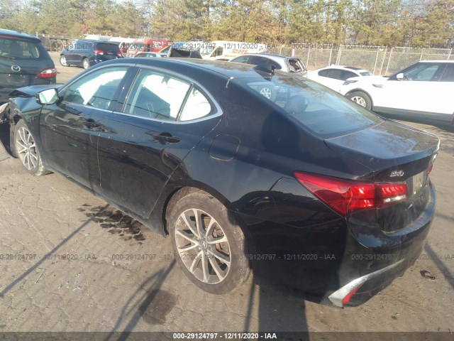 19UUB2F31JA002751  acura tlx 2018 IMG 2