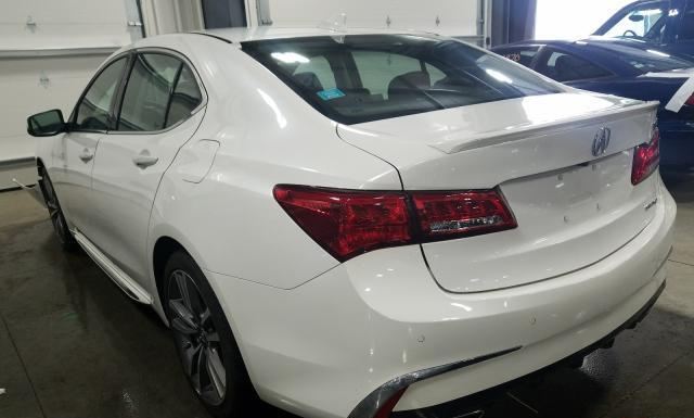 19UUB3F82KA003099  acura tlx 2018 IMG 2