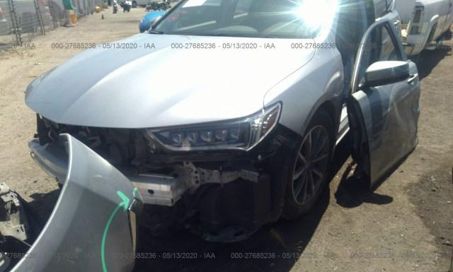 19UUB1F33KA010636  acura tlx 2019 IMG 5