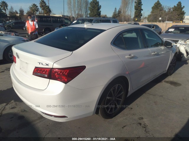 19UUB1F50KA010336  acura tlx 2019 IMG 3