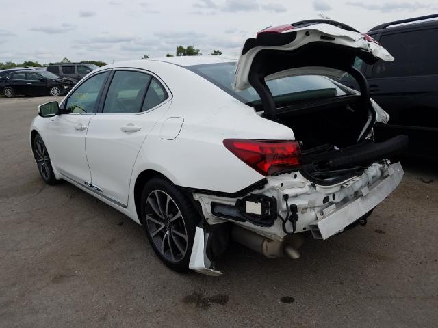 19UUB2F70HA007128  acura tlx advanc 2017 IMG 2