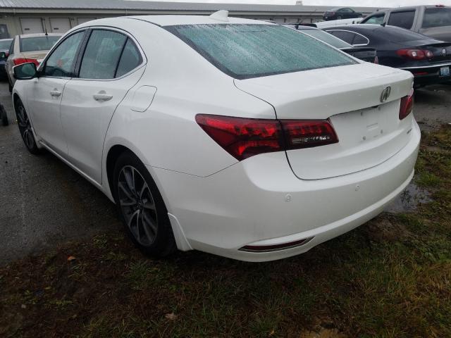 19UUB3F77HA000182  acura tlx advanc 2017 IMG 2