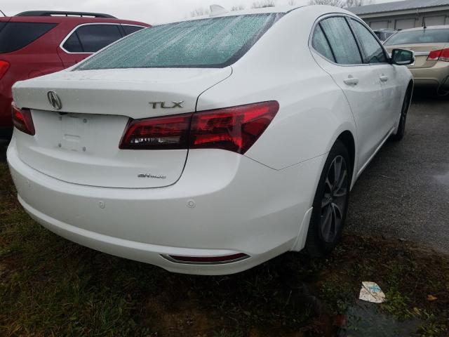 19UUB3F77HA000182  acura tlx advanc 2017 IMG 3