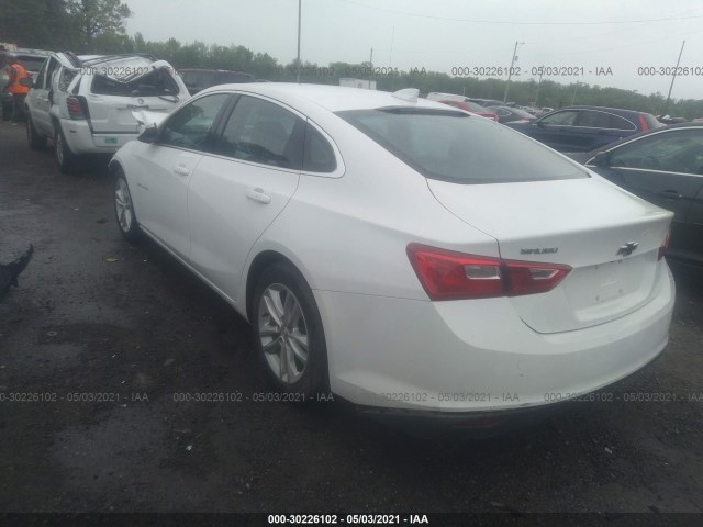 1G1ZD5ST1JF129582  chevrolet malibu 2018 IMG 2