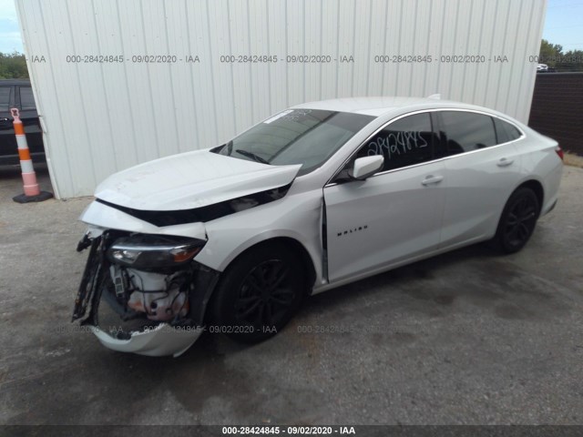 1G1ZD5ST6JF131666  chevrolet malibu 2018 IMG 1