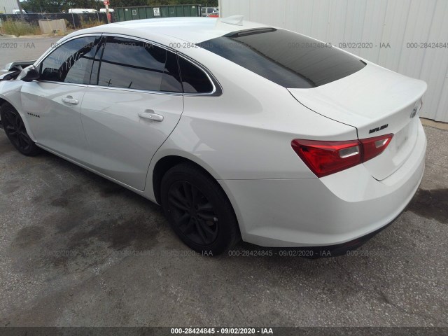 1G1ZD5ST6JF131666  chevrolet malibu 2018 IMG 2