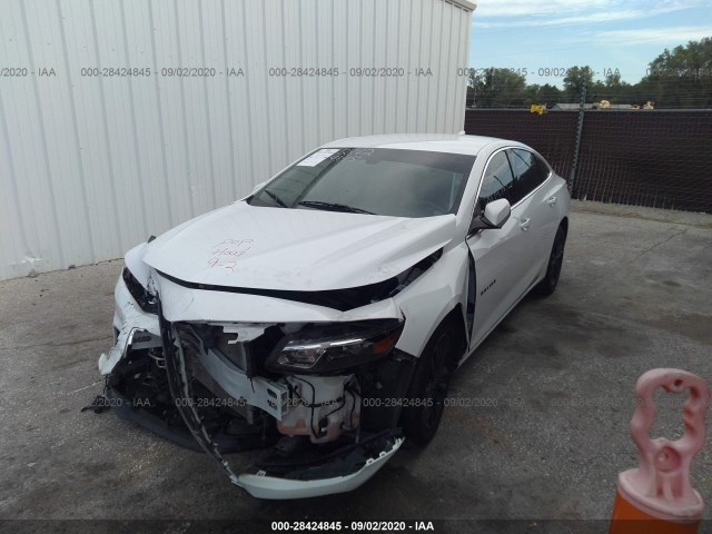 1G1ZD5ST6JF131666  chevrolet malibu 2018 IMG 5