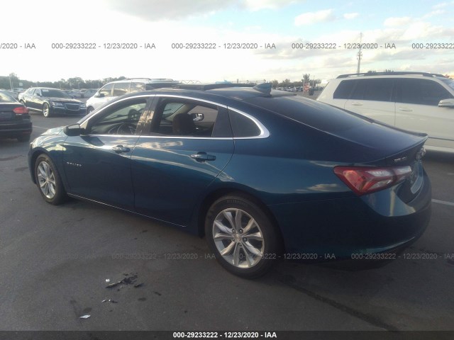 1G1ZD5STXKF140842  chevrolet malibu 2018 IMG 2