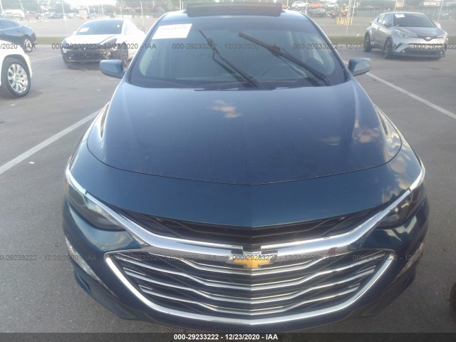 1G1ZD5STXKF140842  chevrolet malibu 2018 IMG 5