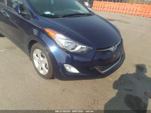 5NPDH4AE4DH261698  hyundai elantra 2013 IMG 5