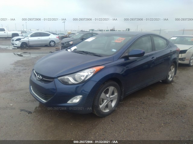 KMHDH4AE5DU572185  hyundai elantra 2013 IMG 1