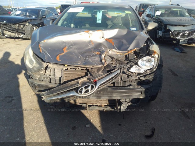 5NPDH4AEXEH479890  hyundai elantra 2014 IMG 5