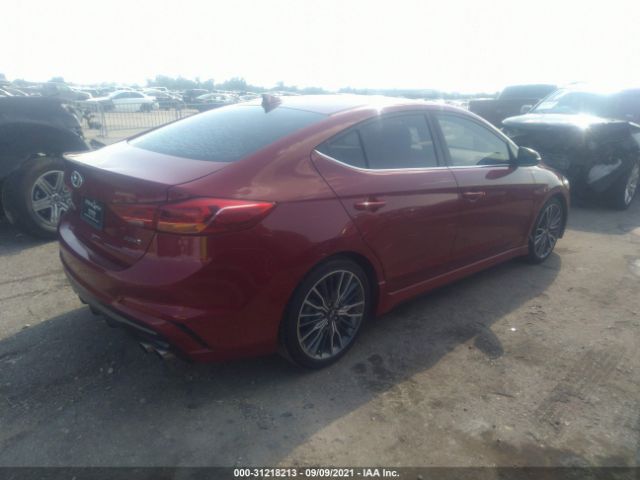 KMHD04LB9HU347011  hyundai elantra 2017 IMG 3