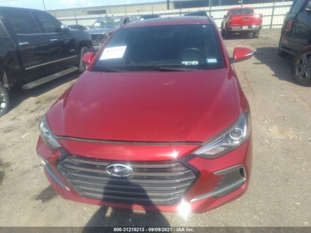 KMHD04LB9HU347011  hyundai elantra 2017 IMG 5