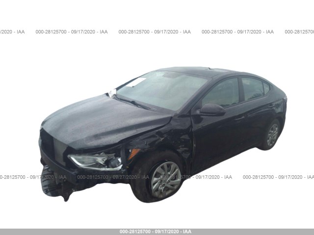 KMHD74LF7HU115571  hyundai elantra 2017 IMG 1