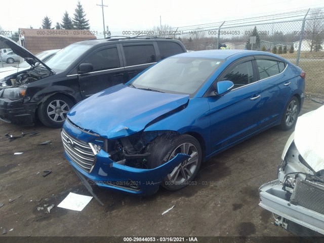 KMHD84LF5HU339239  hyundai elantra 2017 IMG 1