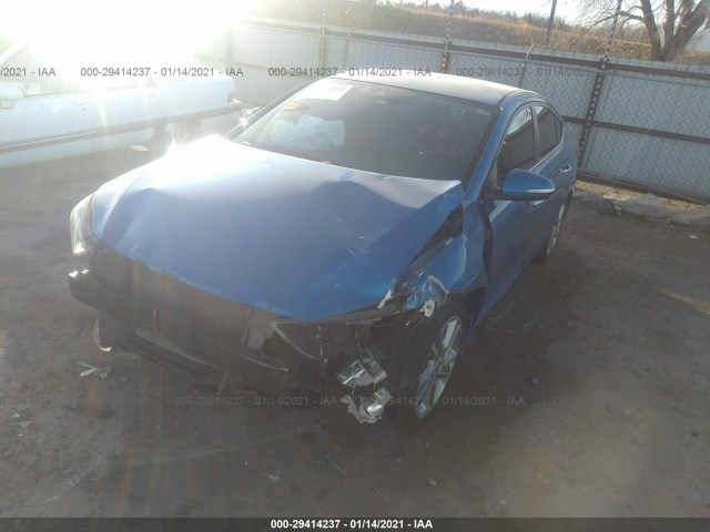 KMHD84LFXHU318340  hyundai elantra 2017 IMG 1