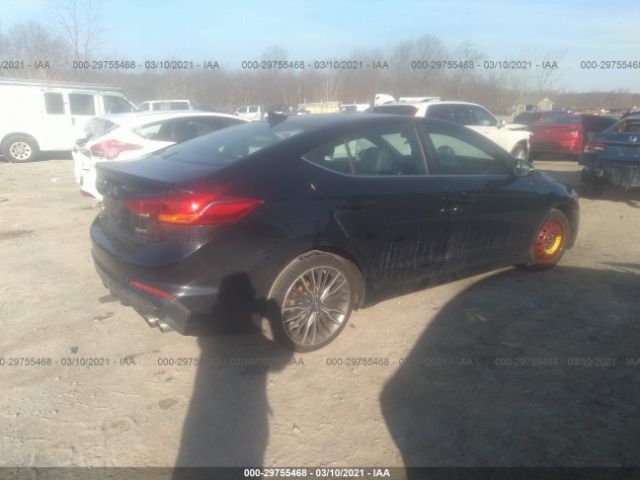 KMHD04LB0JU477927  hyundai elantra 2018 IMG 3