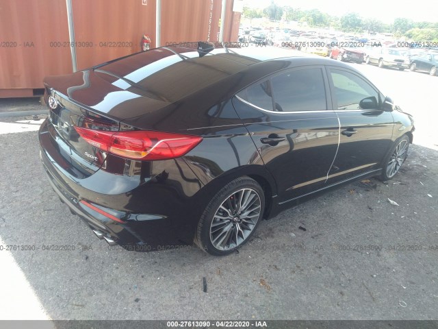 KMHD04LB0JU495019  hyundai elantra 2018 IMG 3