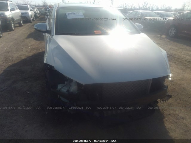 KMHD04LB0JU573198  hyundai elantra 2018 IMG 5