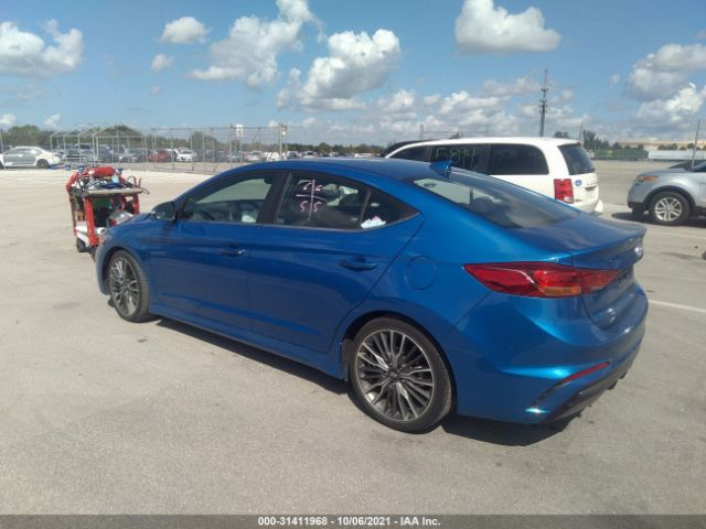 KMHD04LB7JU587017  hyundai elantra 2018 IMG 2