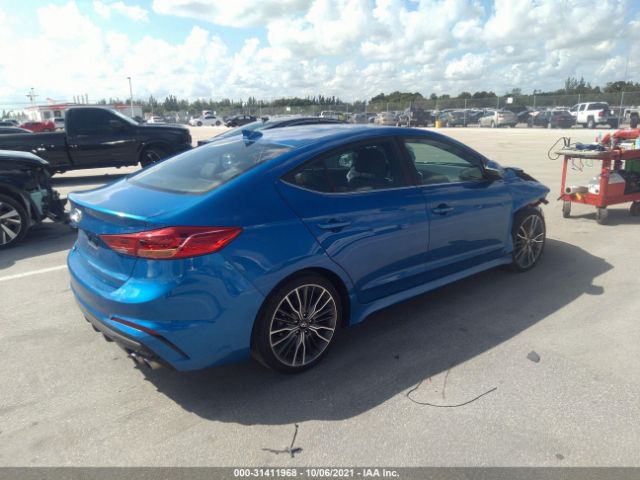 KMHD04LB7JU587017  hyundai elantra 2018 IMG 3