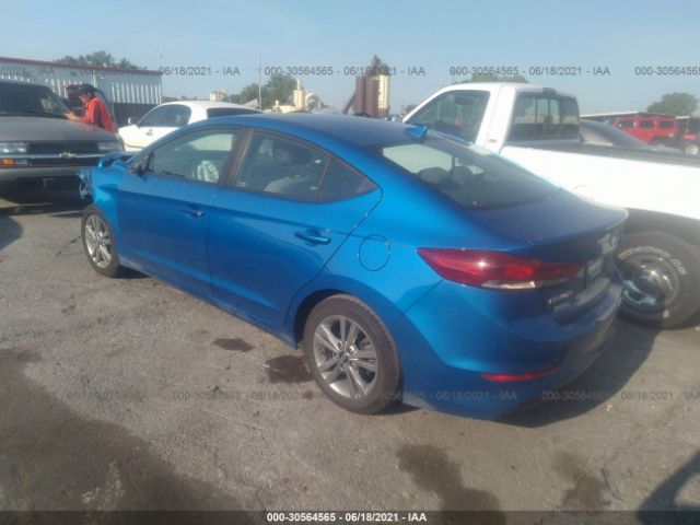 KMHD84LF8JU555124  hyundai elantra 2018 IMG 2