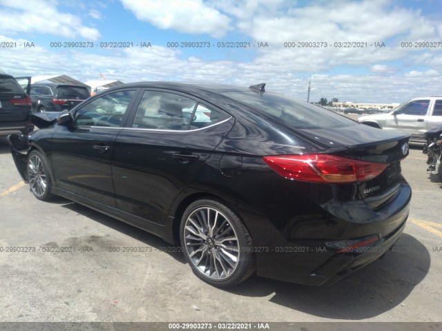 KMHD04LB8JU719573  hyundai elantra 2018 IMG 2