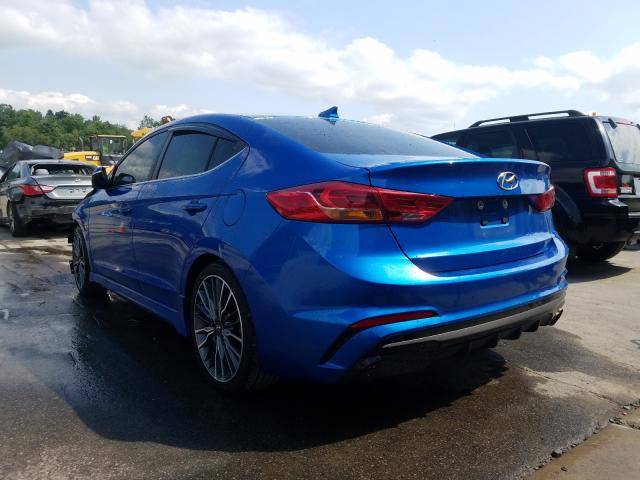 KMHD04LB8HU339210  hyundai elantra sp 2017 IMG 2