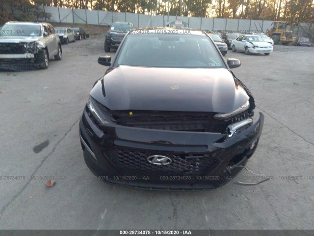 KM8K1CAA8JU178792  hyundai kona 2018 IMG 5