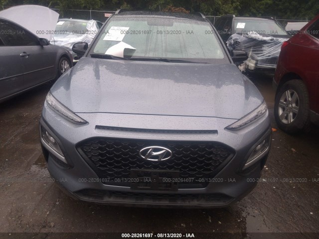 KM8K2CAA4JU160769  hyundai kona 2018 IMG 5